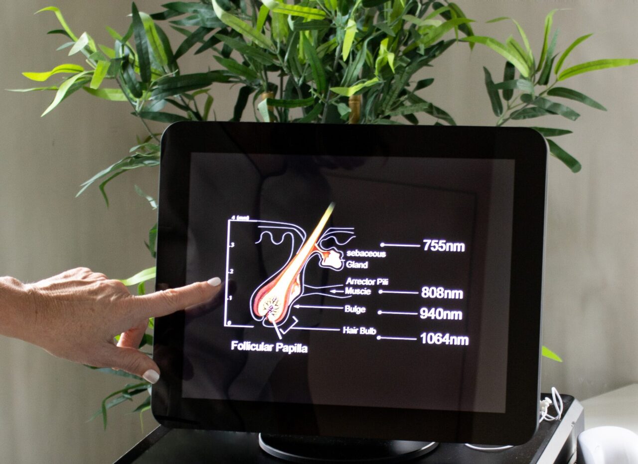 Touchscreen van een diodelaser met de golflengtes 755, 808, 940 en 1064 nanometer